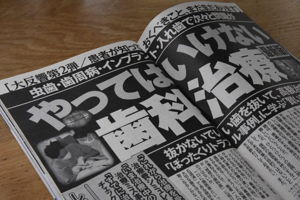 週刊ポスト3/25発売号「やってはいけない歯科治療」（Ｃ）MICHIHIKO IWASAWA
